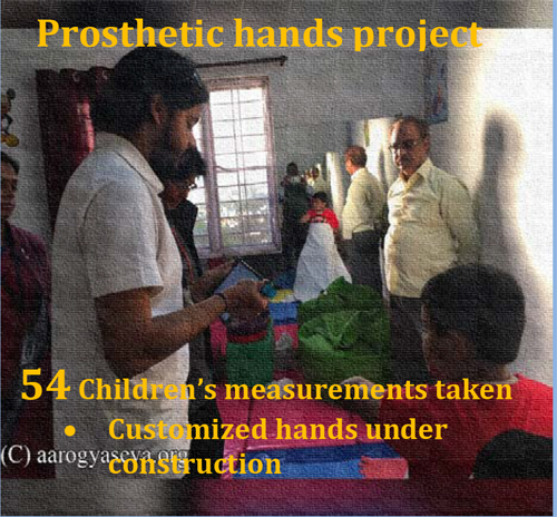 Prosthetic hands