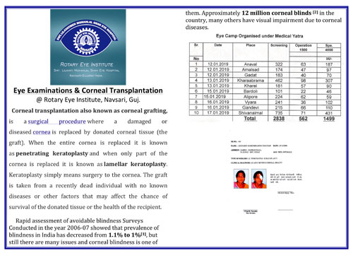 Eye Exams and corneal transplants