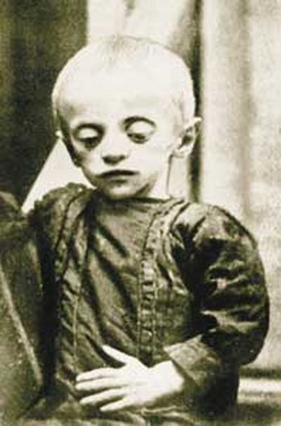 Child victim of the Holodomor. 1933 archive photo made in Ukraine